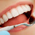 Implant cho răng hàm là gì?