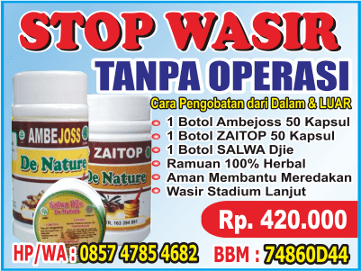 harga produk ambejoss herbal wasir kumat saat hamil, hubungi jual ambejoss herbal wasir kumat saat hamil, tempat jual ambejoss herbal wasir kumat saat hamil