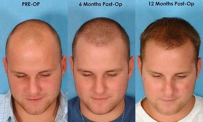 http://hairtransplant.org.pk/