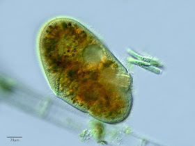 vacuola digestiva