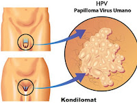 Obat Sakit Kutil Kelamin Apa