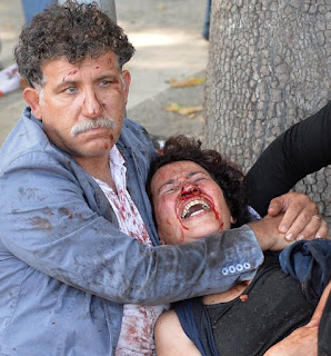 http://www.huffingtonpost.com/entry/ankara-turkey-bomb_5618f904e4b0082030a2c445