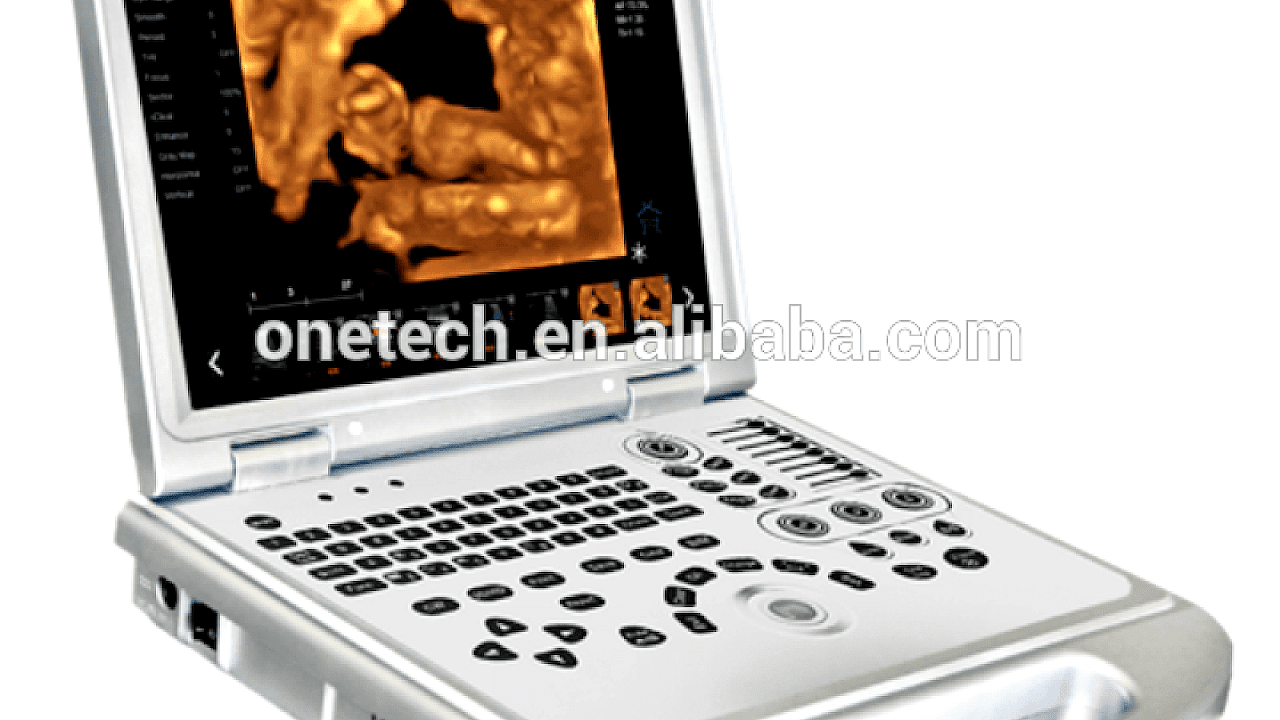 4d Ultrasound Machine Price