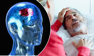 Obat Stroke Herbal Alami, Penyakit Stroke Sebelah Kanan, Cara Mengobati Stroke Secara Herbal, Tanya Pengobatan Stroke Ringan, Cara Cepat Mengobati Gejala Stroke, Fisioterapi Penyakit Stroke, Pantangan Makanan Untuk Penyakit Stroke Ringan, Obat Alami Menyembuhkan Stroke, Obat Alami Stroke Paling Ampuh, Cara Mengobati Penyakit Stroke, Pengobatan Stroke Karena Penyumbatan, Obat Untuk Penyakit Stroke Ringan, Obat Oles Stroke, Obat Jamu Stroke, Penyakit Stroke Disebabkan Karena 