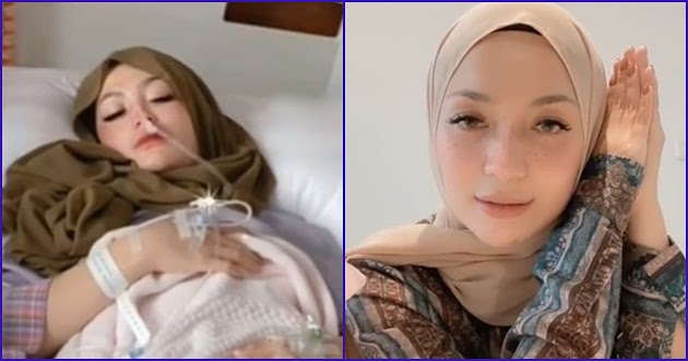 Imel Putri Cahyati Kini Ceritakan Kondisinya Setelah Sembuh dari Kanker Liposarkoma