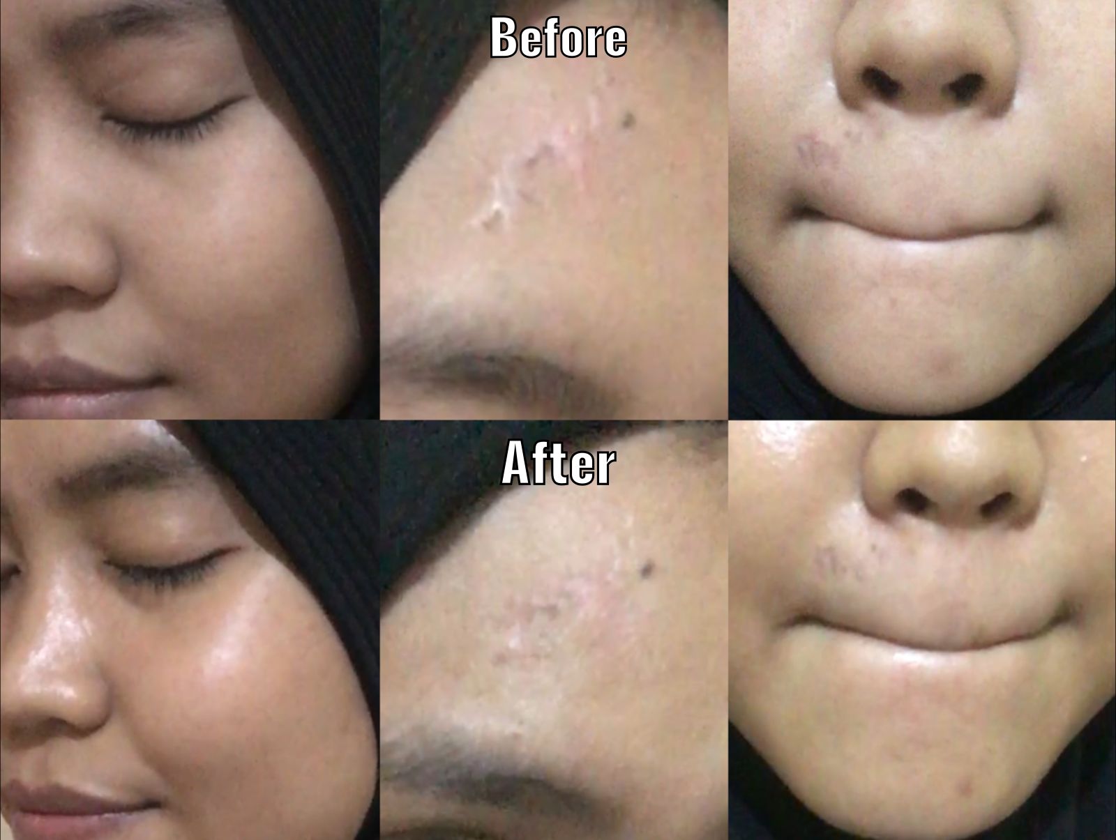 review teratu skin barrier serum