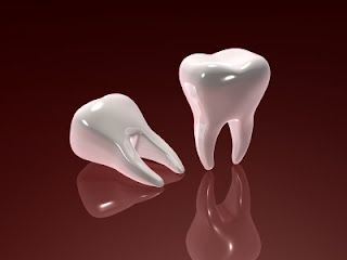 considering dental implants