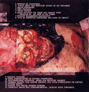 Corrosive Gastric Hemorrage - Extracting the bowels (2011)