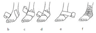 Pembalutan Kaki [warungbidan]