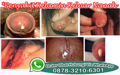 Obat Antibiotik Buat Gonore  Kelamin Keluar Nanah