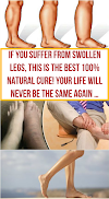 If You Suffer From Swollen Legs, This Is The Best 100% Natural Cure! Your Life Will Never Be The Same Again …