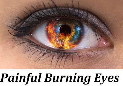 Painful Burning Eyes