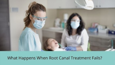 What happens when root canal fails