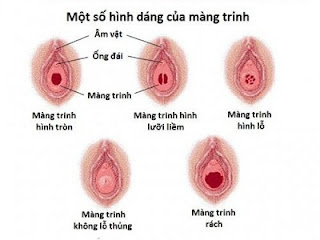 mang-trinh-chua-rach-co-mang-thai-duoc-khong-2