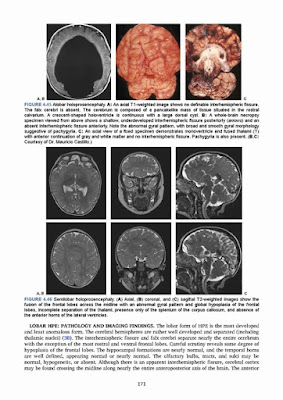 Magnetic Resonance Imaging of the Brain and Spine Fifth Edition