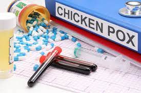 chicken pox in spanish | chicken pox Picture | What is chicken pox | Signs and Symptoms | Complications | Transmission | Prevention and Treatment | Vacunación | chicken pox photo