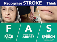 Obat Stroke Tak Bisa Bicara