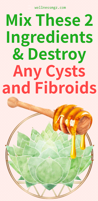 Mix These 2 Ingredients And Destroy Any Cysts And Fibroids