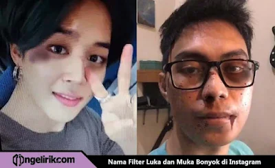 Inilah Nama Filter IG Luka dan Muka Bonyok