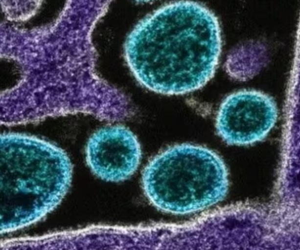 Nipah virus mortality is far higher than that of coronavirus, a government panel says