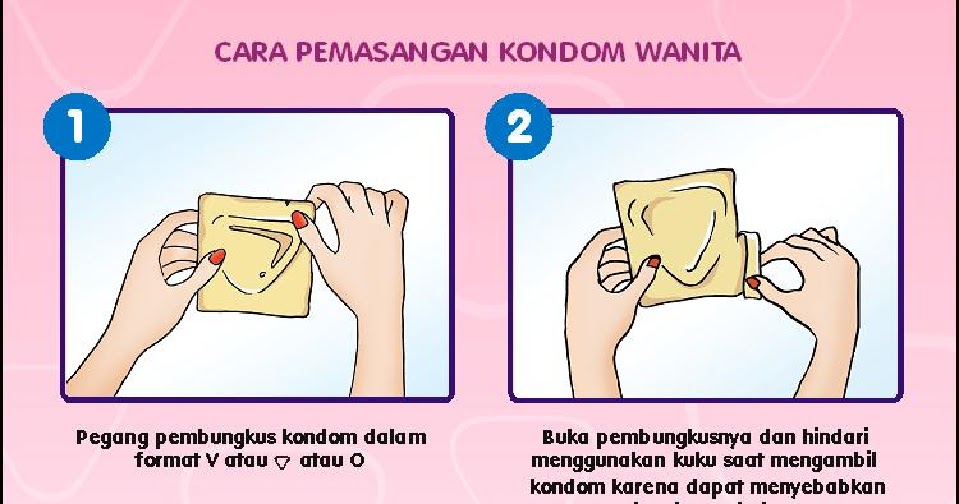 NEW CARA  PASANG KONDOM  UNTUK WANITA