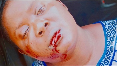 Bloody! PDP Thug, 'Ade-Basket' Assaults Pregnant Woman in Ondo State, Leaves Her in Coma (Graphic Photos)