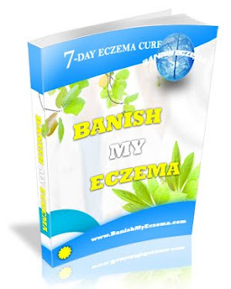 eczema cure . type of cure