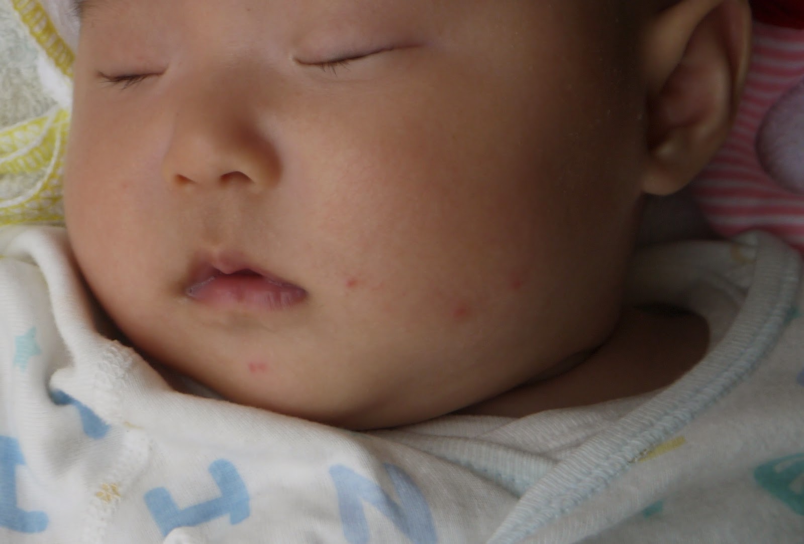 ちいままの育児書 赤ちゃんが蚊に刺された 蚊取り線香 蚊よけ 処置は