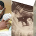 Singer Kizz Daniel Reveals He Had Triplets But One Died, Gifts His Twins A House Each