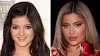 What cosmetic procedures has Kylie Jenner gotten done?