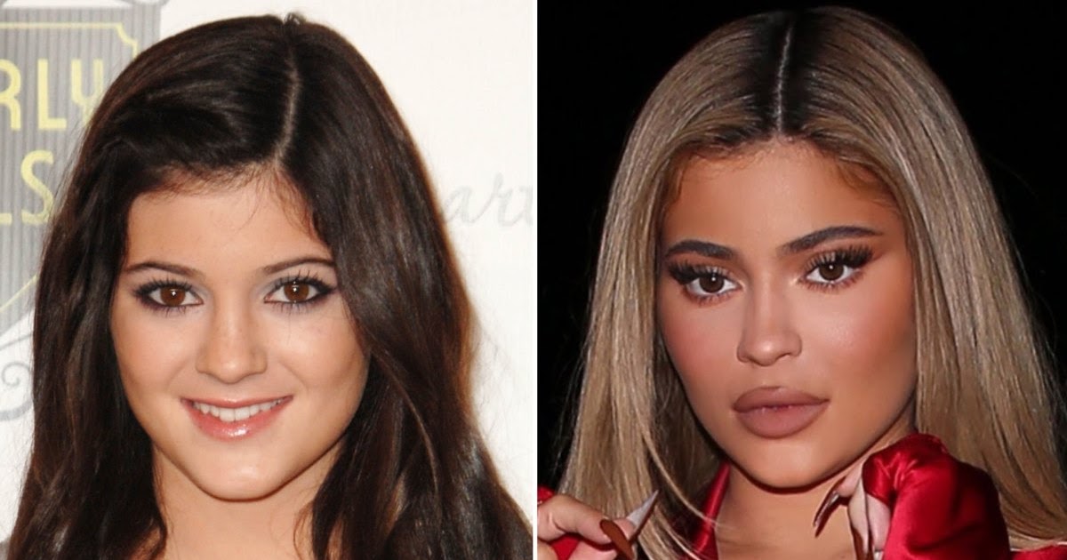 Kylie Jenner Bombshell Bra: Plastic Surgery, Makeup Or Real?