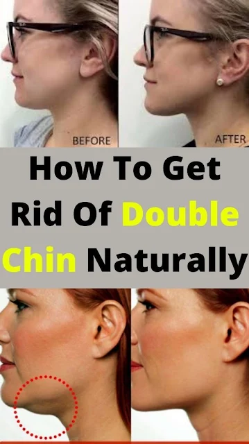 How to Get Rid of Double Chin
