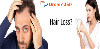 New Medicine will relieve hair loss. 