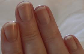bleeding around the nails , basic fingernail care , fingernails healthy and strong , nail have problem , prevent nail damage, keep your fingernails looking their best , Do's and Don'ts for healthy nails