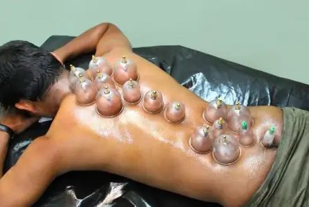 Hijama For Skin Eczema