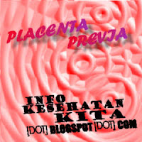 Placenta Previa | Info Kesehatan Kita