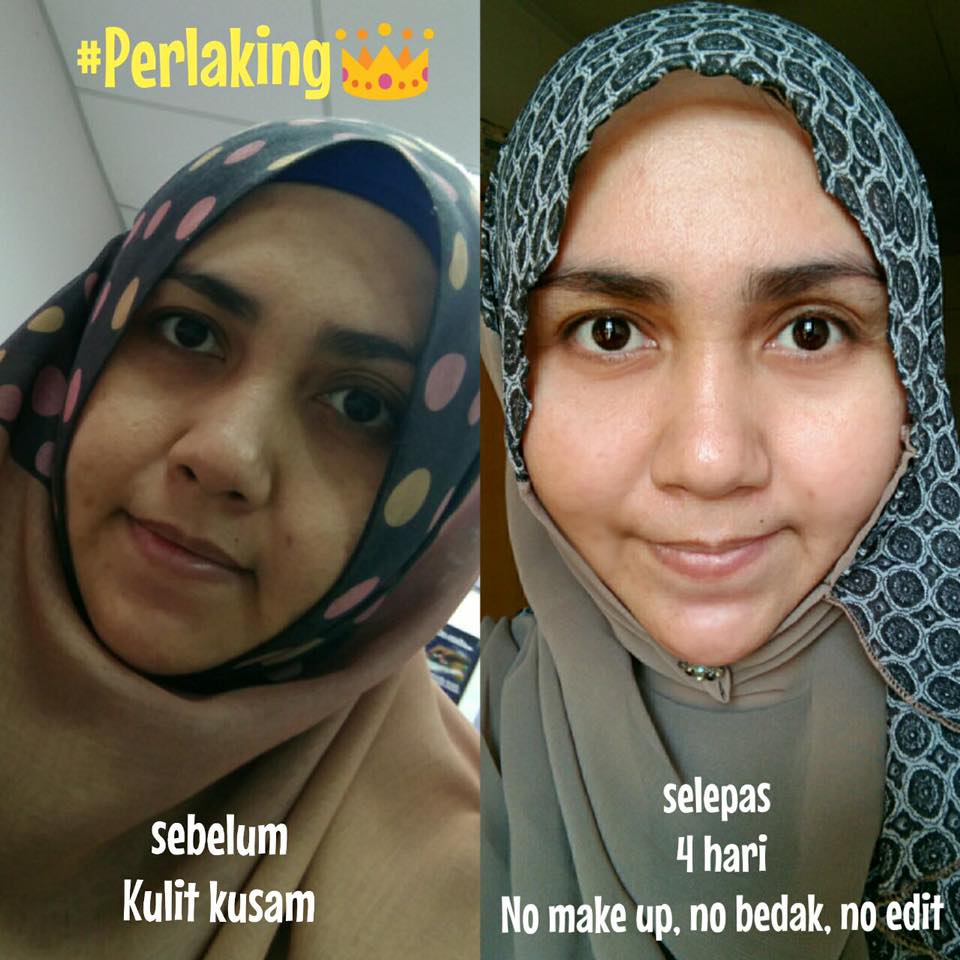 Wanita Dan Kecantikan: PERLA KING 1000,000MG SERBUK 