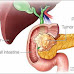 Pancreatic cancer treatment: Why is it so challenging?