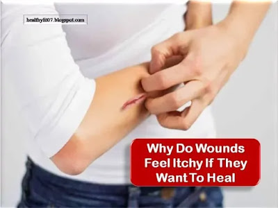 Why Do Wounds Feel Itchy If They Want To Heal