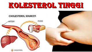 Kolesterol Tinggi : Dampak dan Pencegahannya