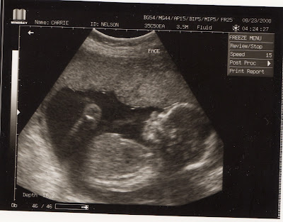 Baby Ultrasound Pictures on Profile Of Baby Girl Jpg