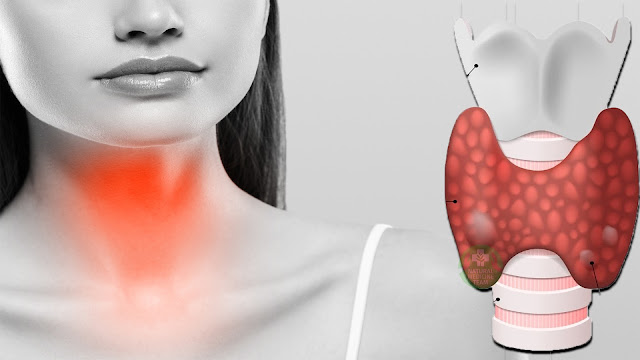 Thyroid Disorder Therapy