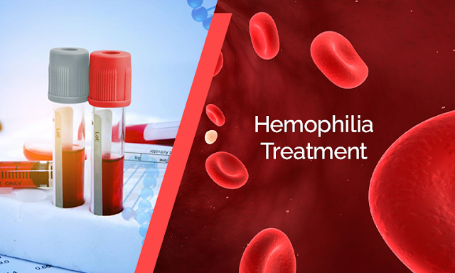 Hemophilia Treatment Market