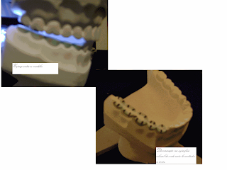 [PDF]Escultura Dental com Auxílio do Método Geométrico Gnatus