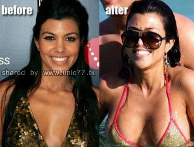 enlarged_celebs_breasts_640_09.jpg (640×484)