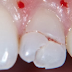 MIRA POR QUE DEBES MANTENER LOS DIENTES PRIMARIOS DE TUS HIJOS!!! SORPRENDENTE!!