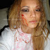 Picture: Tila Tequila Attacked By Insane Clown Posse Fans Photos