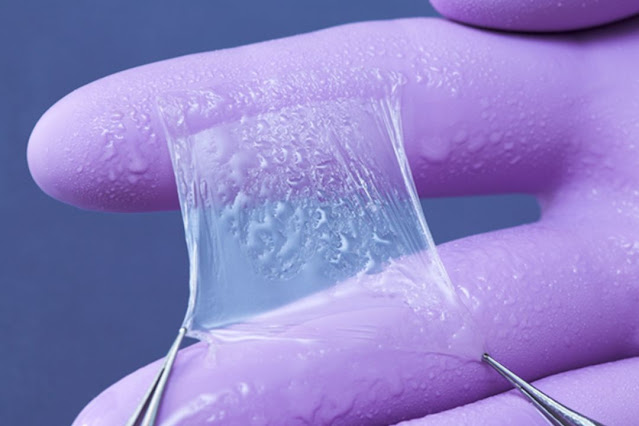 Amniotic Membrane Market