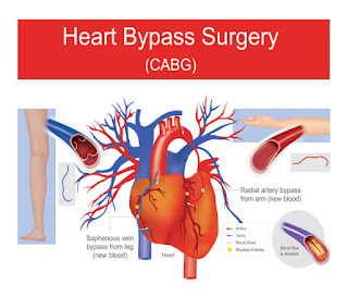 heart-attack-its-symptoms-causes and-treatments