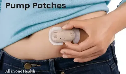 Pump Patches: The Affordable Option For Insulin Pump Prices